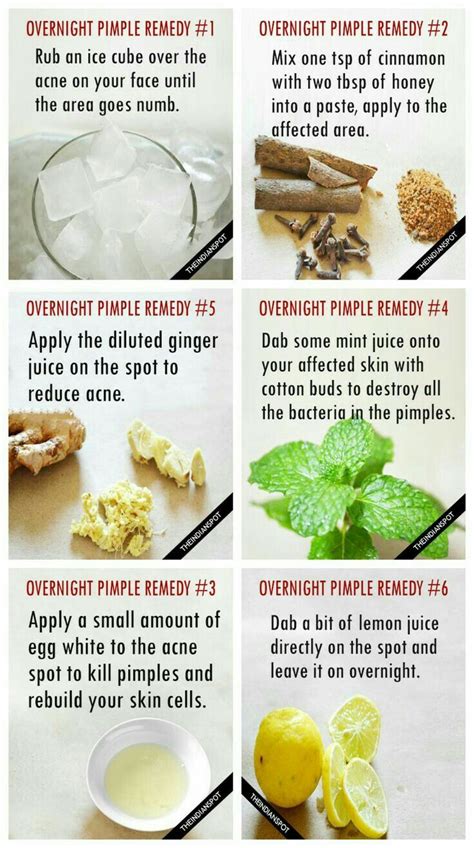 Overnight Pimple Remedies, Pimples Remedies, Pimples Overnight, Skin Care Remedies, Herbal ...