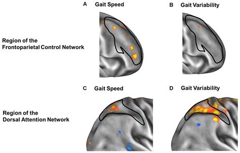 Frontiers | Gait Speed and Gait Variability Are Associated with Different Functional Brain Networks