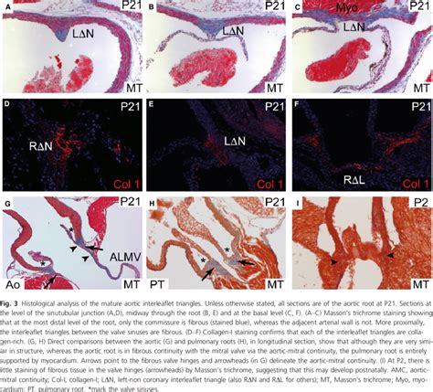 Histological analysis of the mature aortic valve sinus walls. (A,B ...