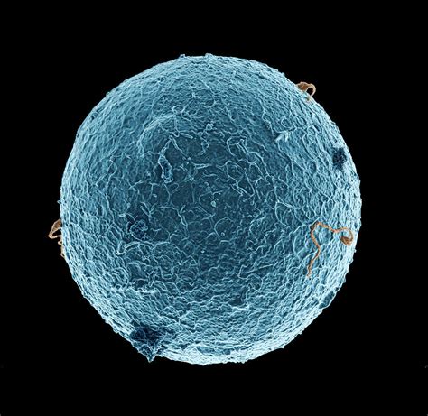 Human Egg Cell And Sperm Cells Photograph by Thierry Berrod, Mona Lisa ...