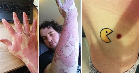 35 Genius Birthmark Cover-Up Tattoos | Bored Panda