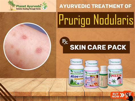 #Prurigo #Nodularis is also known as #Picker #Nodules and #Hyde’s # ...