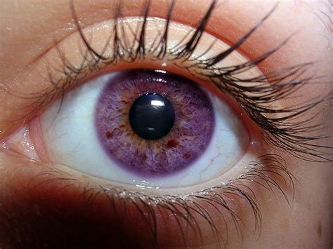 Heterochromia | Violet eyes, Eye close up, Rare eye colors