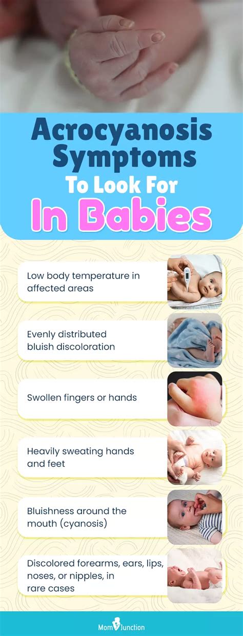 Acrocyanosis In Newborn: Causes, Symptoms, Diagnosis And Treatment