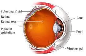 detached retina surgery