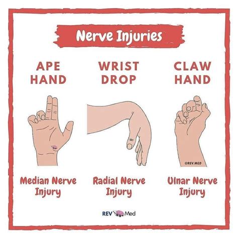 Read More and Download Book immediately #repost @medical.graph Median ...