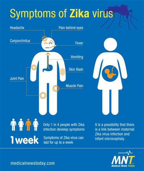 Manifestaciones oculares congénitas del virus Zika - Qvision