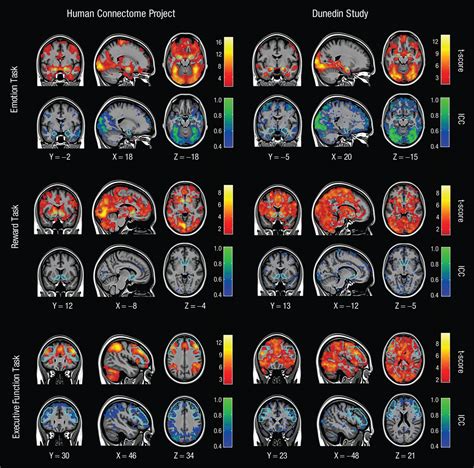 Scientists have used fMRI to study brain activity for years. Now, some question the results ...