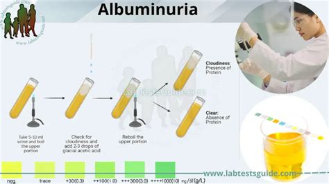 Albuminuria: Causes, Symptoms, Testing, Results, and Treatment