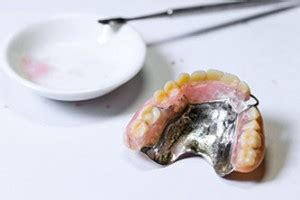 » Repair broken partial denture