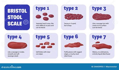 Bristol Stool Scale Composition Stock Vector - Illustration of organic, value: 244459955