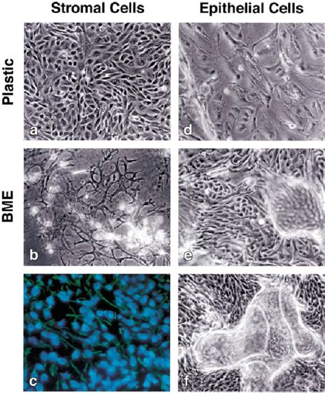 Photomicrographs of endometrial epithelial and stromal cells under... | Download Scientific Diagram