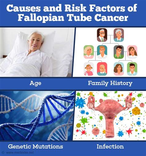 Fallopian Tube Cancer - Risk Factors, Diagnosis and Management