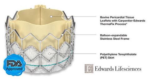 Transcatheter Heart Valve Technology For Valvular Disorders