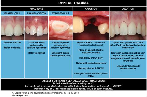 Episode 62 – Dental Emergencies – FOAMcast