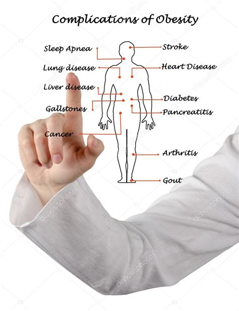 Diagram of Complications of Obesity Stock Photo by ©vaeenma 124527470