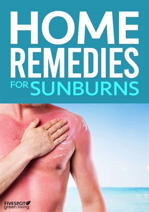 The Best Home Remedies for Sunburn Relief - Five Spot Green Living