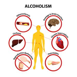 Can Alcoholism Negatively Impact Your Health? | RACNJ