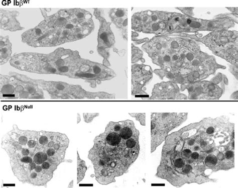 Transmission electron microscopy of purified platelets. Platelet-rich ...