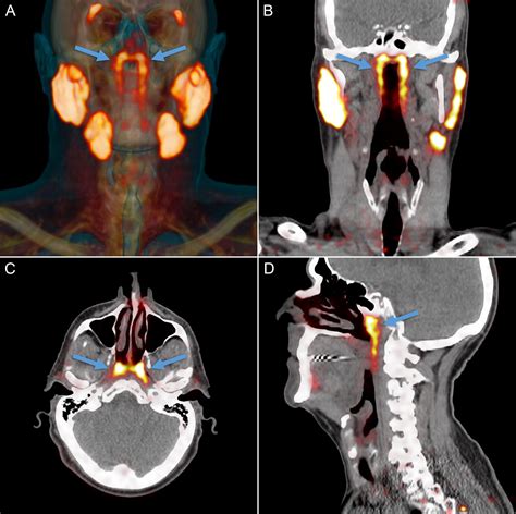 Anatomy of a Discovery: Exploring the Impact of New Salivary Gland Finding | Temerty Faculty of ...