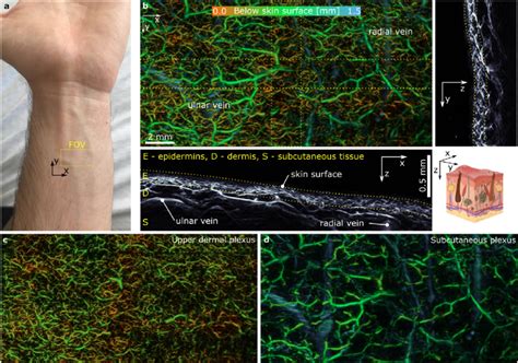 Application of cMBR to recover the vasculature in human skin. a)... | Download Scientific Diagram