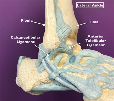 Understanding the Diagnosis of a High Ankle Sprain