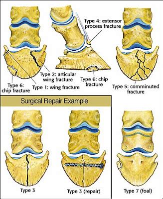 Behind the Bit: Coffin bone fractures: What to look for...