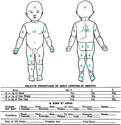 Burns- Children and Infants: Lund browder chart | Chart, Lund, Children