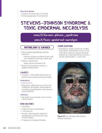 Stevens-Johnson syndrome: Video, Causes, & Meaning | Osmosis