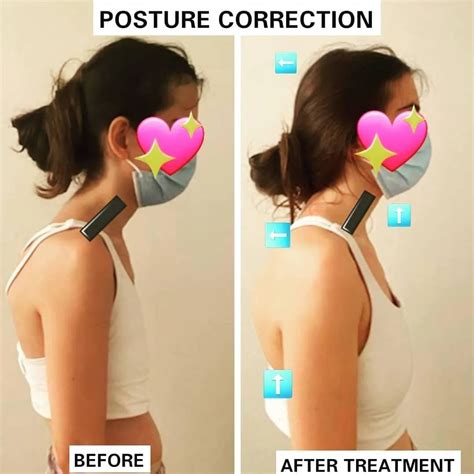 Posture Correction – Nadia The Osteopath