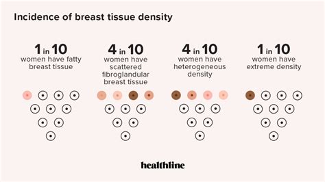 Fibroglandular Density (Dense Breast Tissue): What It Means