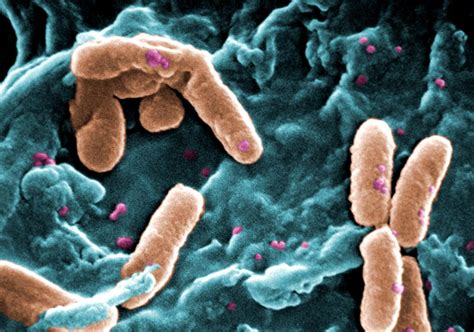 Pseudomonas, svelato meccanismo di resistenza del superbatterio - Galileo