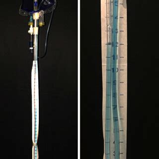 A: The intra-abdominal pressure measurement system is attached to a 500... | Download Scientific ...