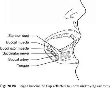 Cheek Advancement - Facial Plastic - Barnard Health Care