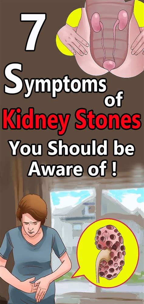 7 Symptoms of Kidney Stones You Should be Aware of - Healthy Lifestyle