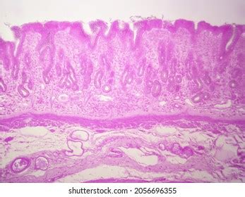 Histology Microscope Image Pyloric Region Stomach Stok Fotoğrafı ...