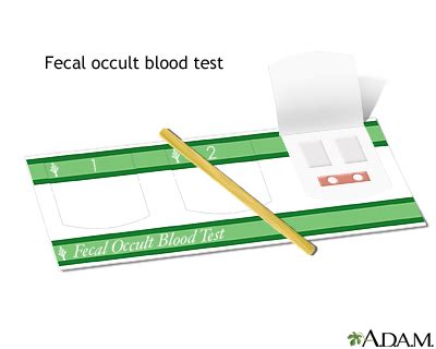 Fecal occult blood test: MedlinePlus Medical Encyclopedia Image