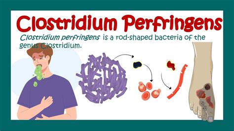 Clostridium Perfringens In Food