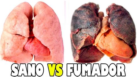 Diferencia entre pulmón sano y de fumador - YouTube