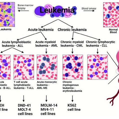 The different types of human leukemia cell lines. (Created with ...