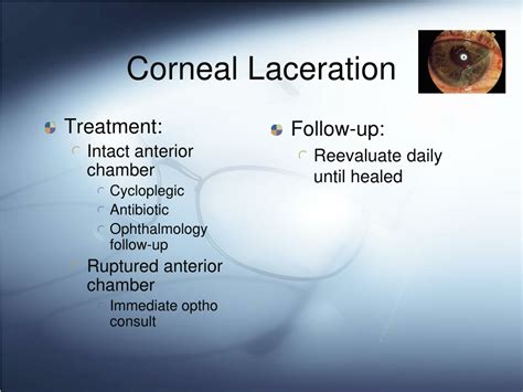 PPT - Corneal Disease PowerPoint Presentation, free download - ID:9723653