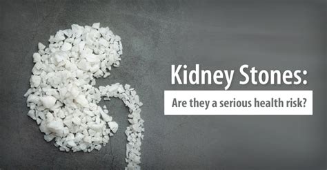 Kidney Stones - Symptoms Risk Factors Diagnosis & Treatment