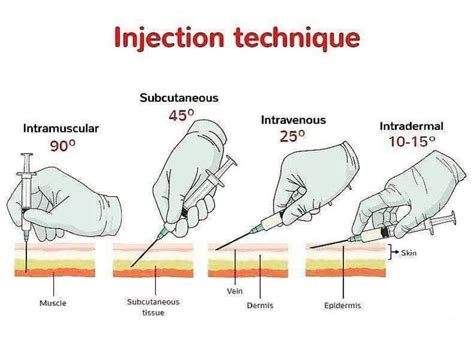 Injection types : coolguides | Medical assistant student, Medical school inspiration, Nursing ...