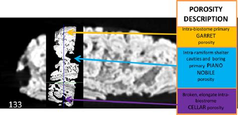 High-resolution micro-CT image nested within the low-resolution CT... | Download Scientific Diagram