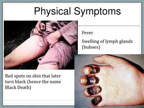 PPT - The Plague Black Death- Bubonic Plague PowerPoint Presentation ...