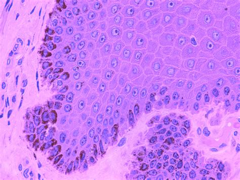 Melanocytes and Langerhans Cells