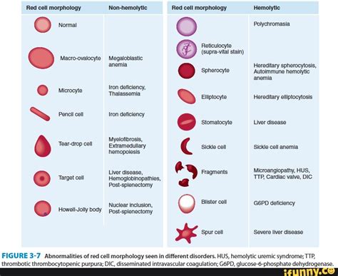 Sharing my click hole. -warning- blood. - Red cell morphology Non-hemolytic Red cell morphology ...