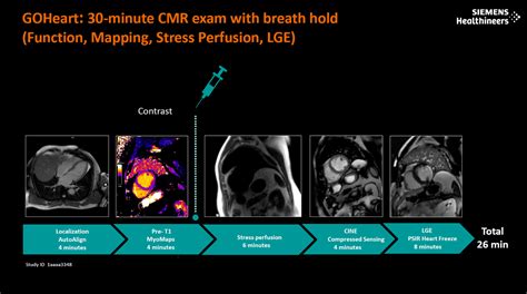 Cardiac Dot Engine - Siemens Healthineers