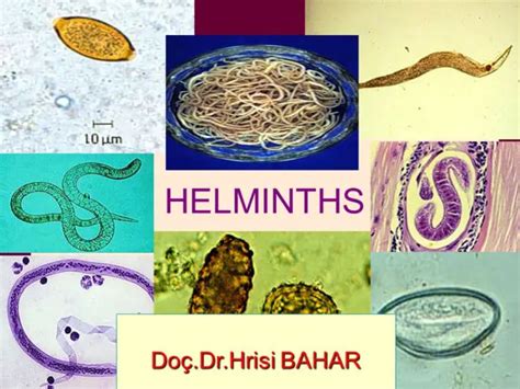 Helminths (Parasitic Worm) and How They Affect You | Healthtian