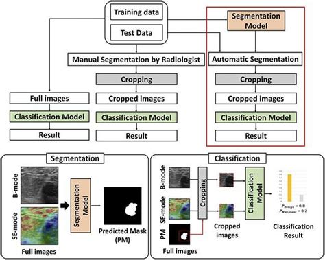 AI-powered ultrasound imaging that detects breast cancer